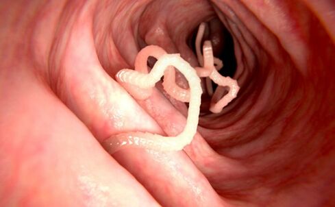 crvi u ljudskom tijelu