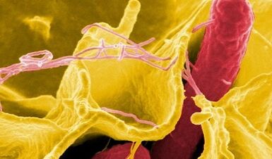 Znakovi parazita u ljudskom tijelu