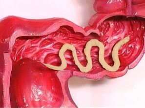 paraziti u ljudskom tijelu zašto se pojavljuju