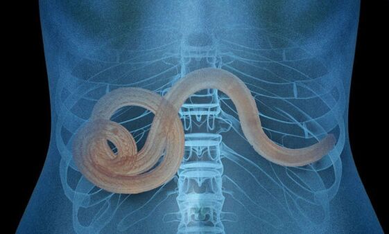 parazit u ljudskom tijelu