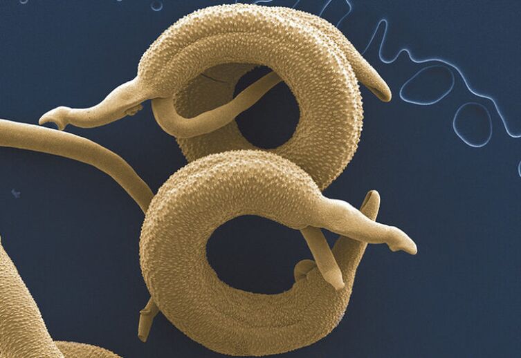 paraziti koji žive u ljudskom tijelu