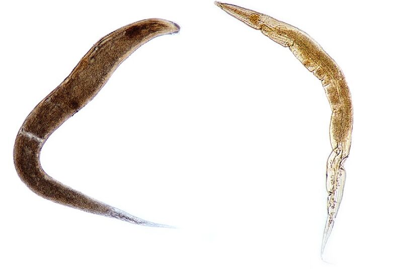 pinworms u tijelu djece